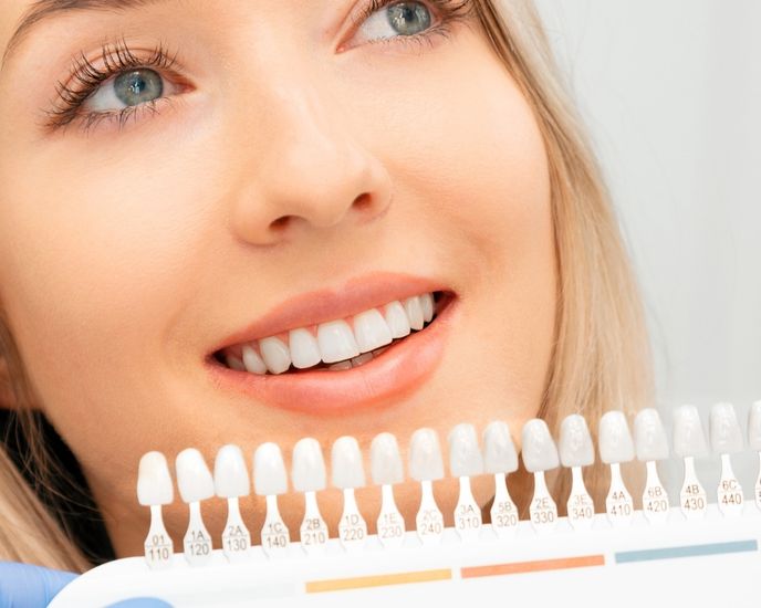 Carillas dentales y diseño de sonrisa